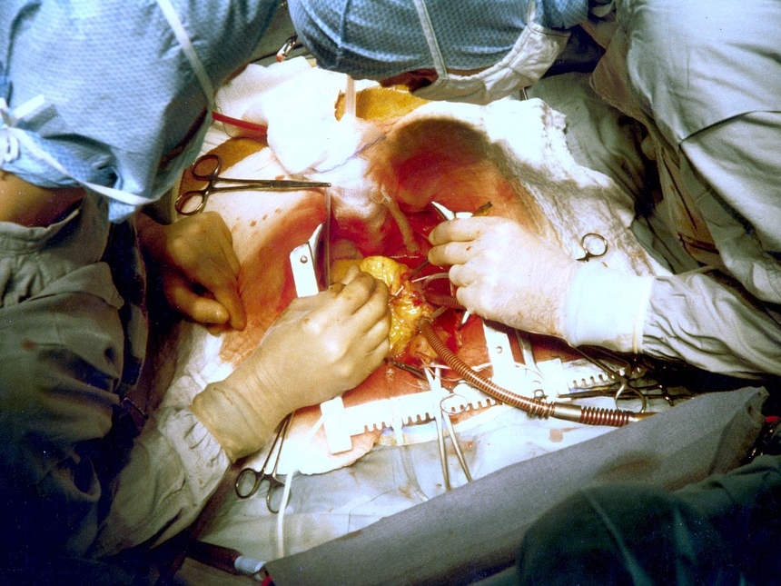 Image for Нижегородские хирурги за год провели тысячу операций на сердце с искусственным кровообращением