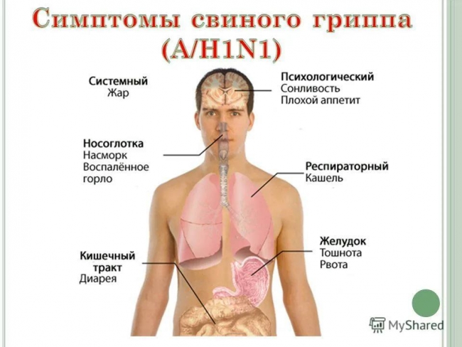 Image for Глава нижегородского минздрава рассказал о методике лечения свиного гриппа