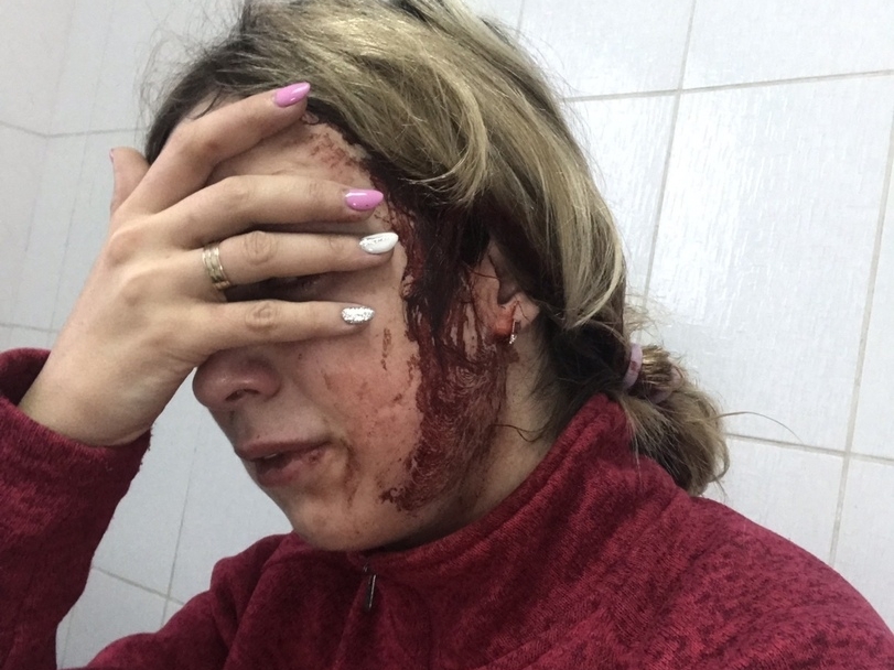 Image for Нижегородку с грудным ребенком на руках избили из-за неправильной парковки