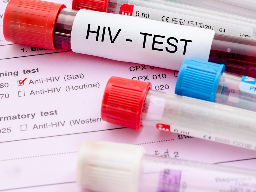 Нижегородцы смогут бесплатно провериться на ВИЧ в центре города